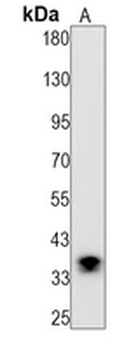 GDF15 Rabbit Monoclonal Antibody
