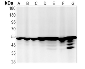 Glutathione Synthetase Rabbit Monoclonal Antibody