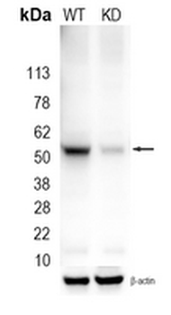 Glutathione Synthetase Rabbit Monoclonal Antibody