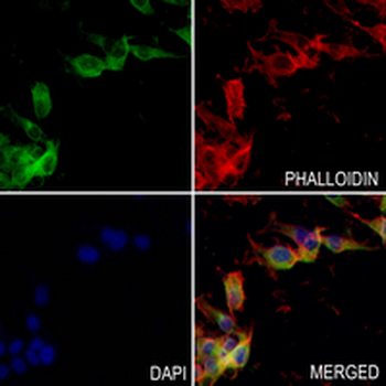 TAB1 Rabbit Monoclonal Antibody