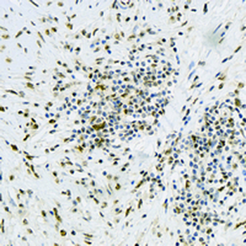 DDB1 Rabbit Monoclonal Antibody