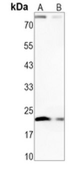 IL-23 alpha Rabbit Monoclonal Antibody
