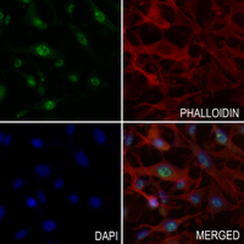 PSMA1 Rabbit Monoclonal Antibody
