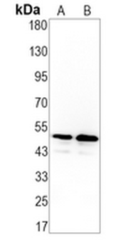 CD213a1 Rabbit Monoclonal Antibody