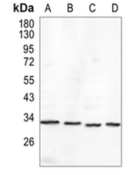 Tropomyosin Rabbit Monoclonal Antibody
