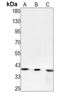 NDEL1 Rabbit Monoclonal Antibody