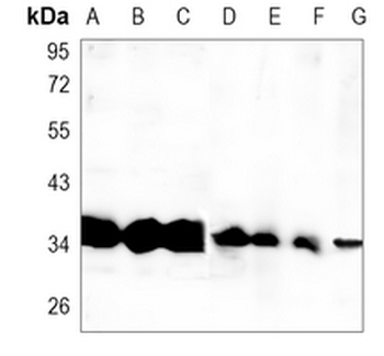 CHIP Rabbit Monoclonal Antibody