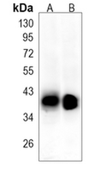 ADH1 Rabbit Monoclonal Antibody