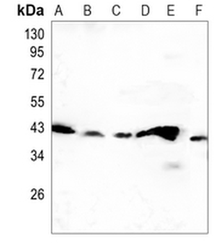 Creatine Kinase B Rabbit Monoclonal Antibody