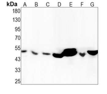 TMPRSS2 Rabbit Monoclonal Antibody