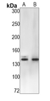 Pumilio 1 Rabbit Monoclonal Antibody