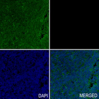 Pumilio 1 Rabbit Monoclonal Antibody