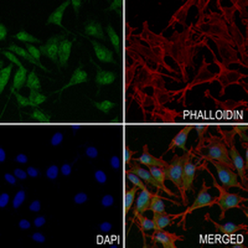 Pumilio 1 Rabbit Monoclonal Antibody