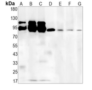 ILF3 Rabbit Monoclonal Antibody