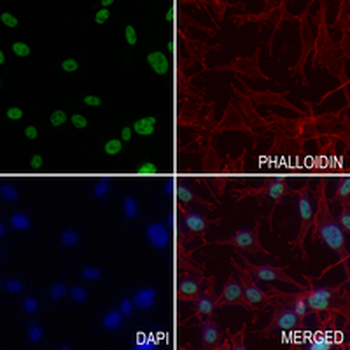 RbAp48 Rabbit Monoclonal Antibody