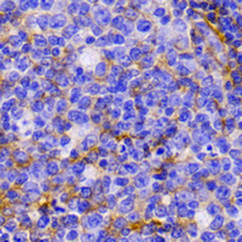 Complement C3 Rabbit Monoclonal Antibody