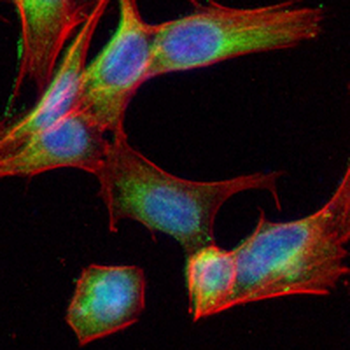 Complement C3 Rabbit Monoclonal Antibody