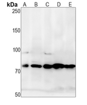 CD127 Rabbit Monoclonal Antibody