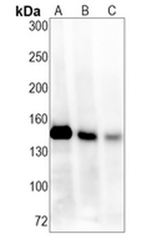 KDM4A Rabbit Monoclonal Antibody