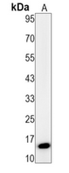 p14 ARF Rabbit Monoclonal Antibody
