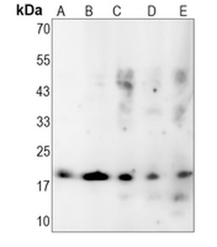 p18 INK4c Rabbit Monoclonal Antibody