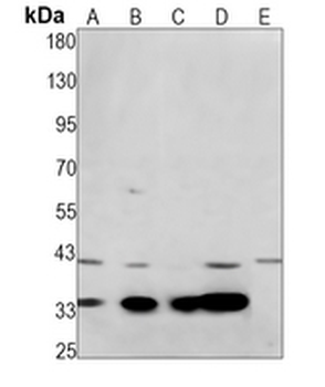 ACP5 Rabbit Monoclonal Antibody