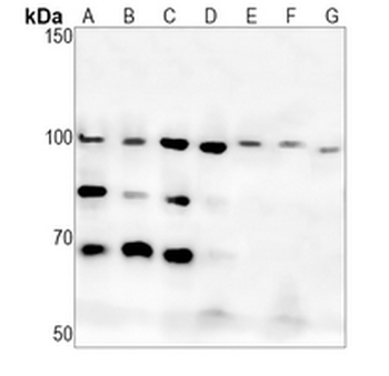 DISC-1 Rabbit Monoclonal Antibody