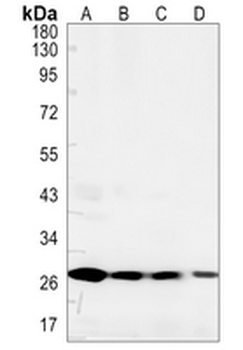 ANP32B Rabbit Monoclonal Antibody