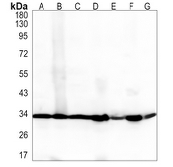 PHB2 Rabbit Monoclonal Antibody