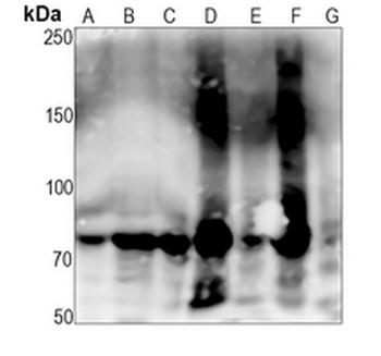 POR Rabbit Monoclonal Antibody