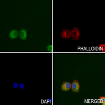 POR Rabbit Monoclonal Antibody