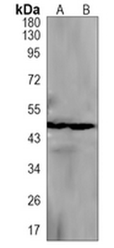 EIF4A3 Rabbit Monoclonal Antibody