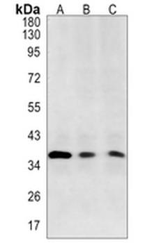 TARBP2 Rabbit Monoclonal Antibody