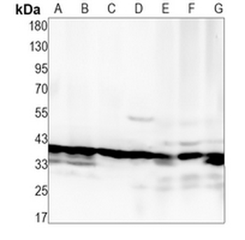 VPS26A Rabbit Monoclonal Antibody