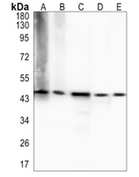 DDX39B Rabbit Monoclonal Antibody