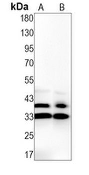 SET Rabbit Monoclonal Antibody