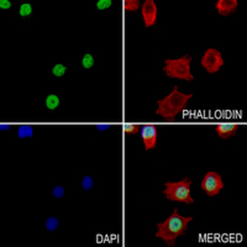 SET Rabbit Monoclonal Antibody