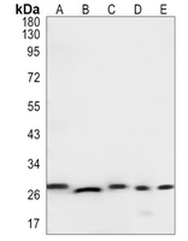 CHMP3 Rabbit Monoclonal Antibody