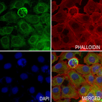 Gephyrin Rabbit Monoclonal Antibody