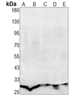 ERP29 Rabbit Monoclonal Antibody