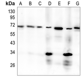 PDC-E2 Rabbit Monoclonal Antibody