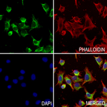 PDC-E2 Rabbit Monoclonal Antibody