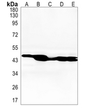 ASS1 Rabbit Monoclonal Antibody
