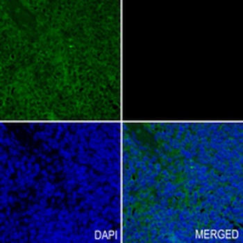 ASS1 Rabbit Monoclonal Antibody