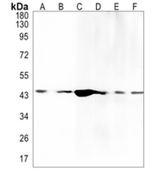 IDH1 Rabbit Monoclonal Antibody