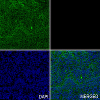 IDH1 Rabbit Monoclonal Antibody