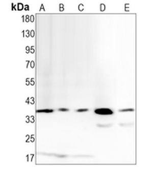 RING1b Rabbit Monoclonal Antibody