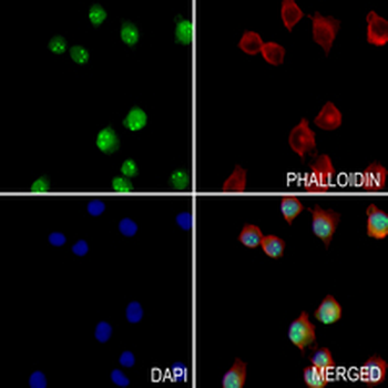 RING1b Rabbit Monoclonal Antibody
