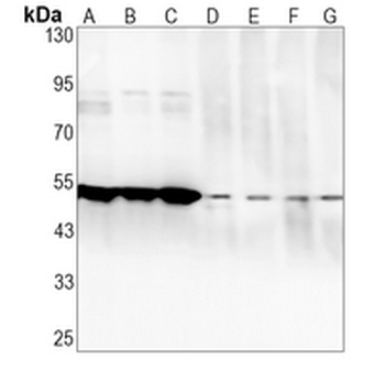 RCK Rabbit Monoclonal Antibody