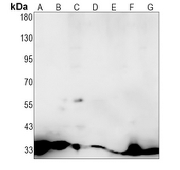 SPRY4 Rabbit Monoclonal Antibody